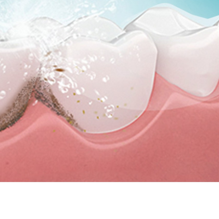 Colgate Blast mostrando limpieza entre dientes